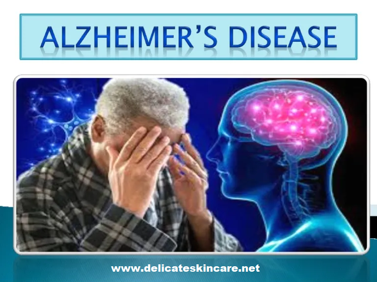 Recognizing and managing symptoms of Alzheimer’s disease